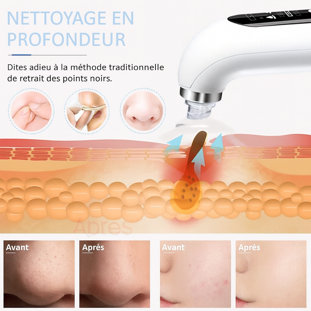 Aspirateur électrique points noirs – Nettoyeur de pores micro-bulles rechargeable USB, soin visage en profondeur